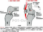 膝の内側側副靭帯（medial collateral ligament：MCL）の機能解剖